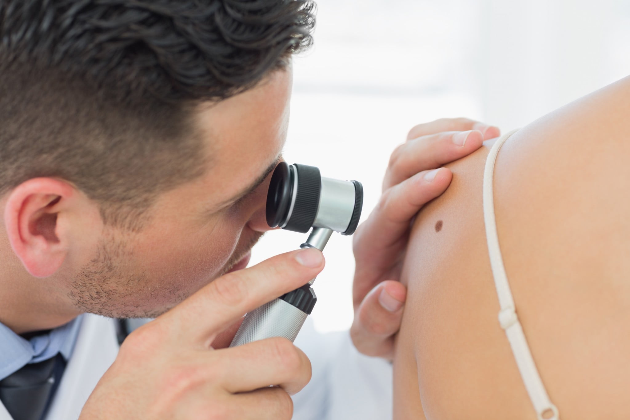 melanoma: dermatologist examines mole on woman's shoulder
