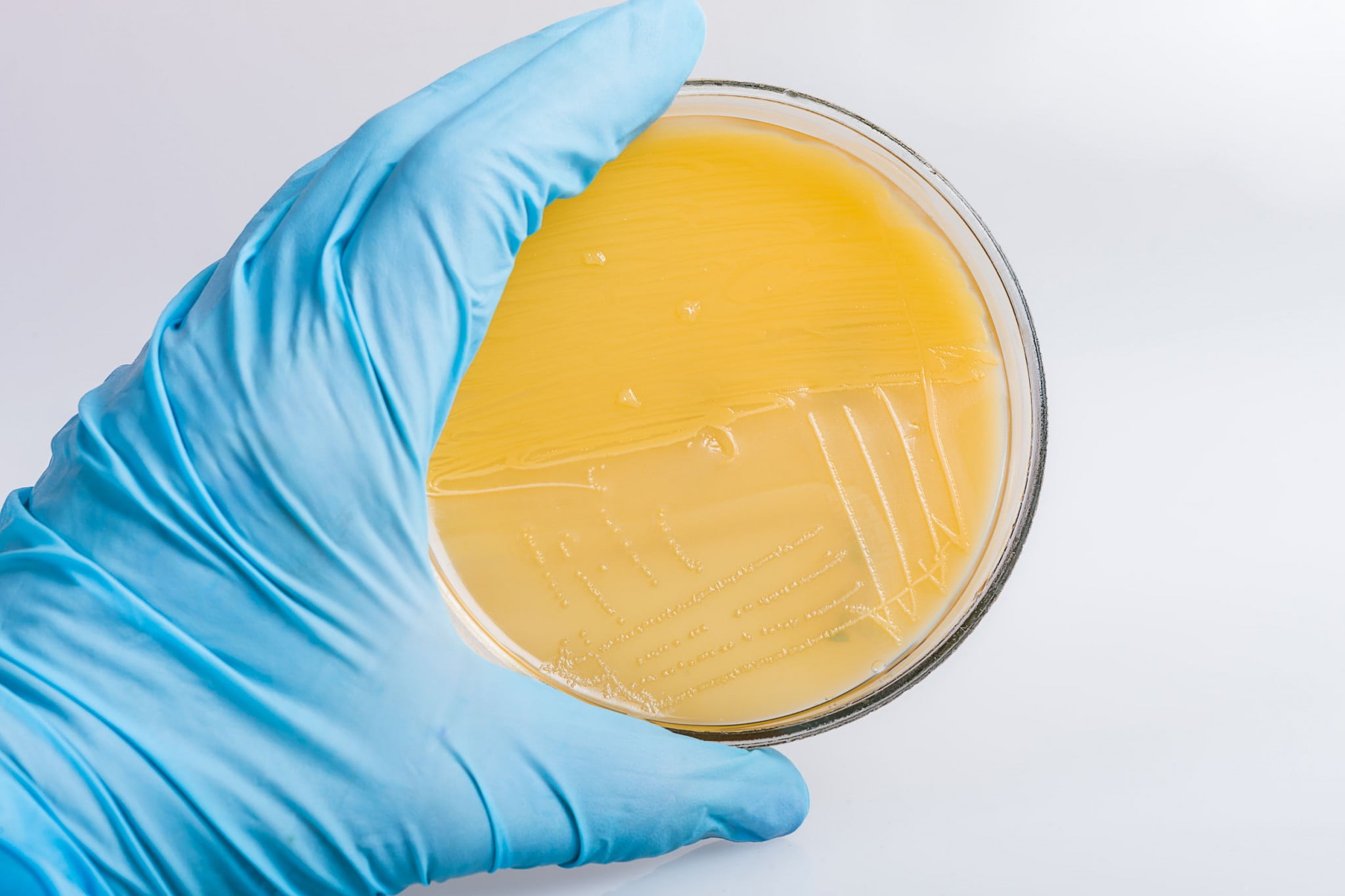 petri dish