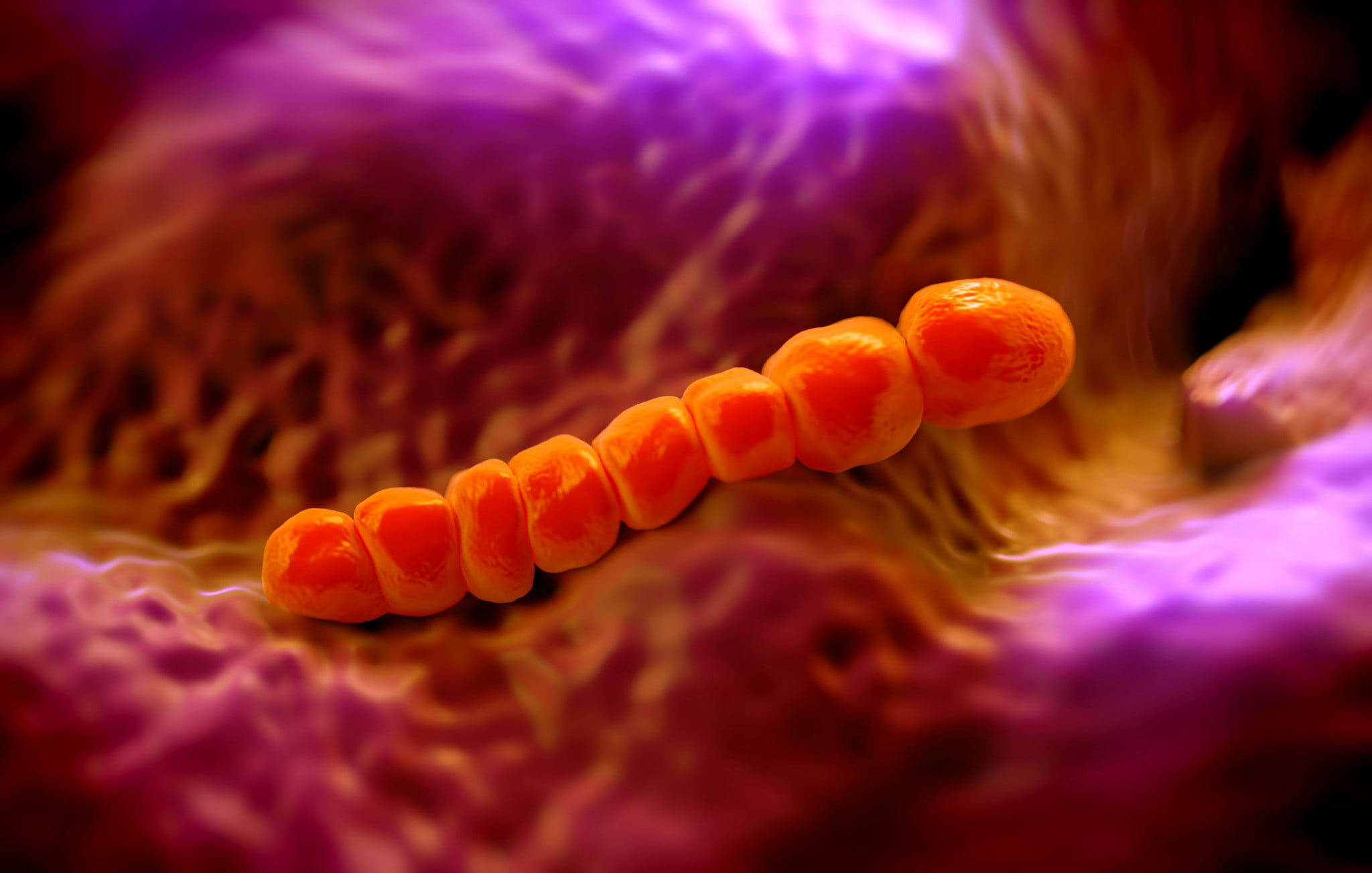 pneumococcal pneumonia