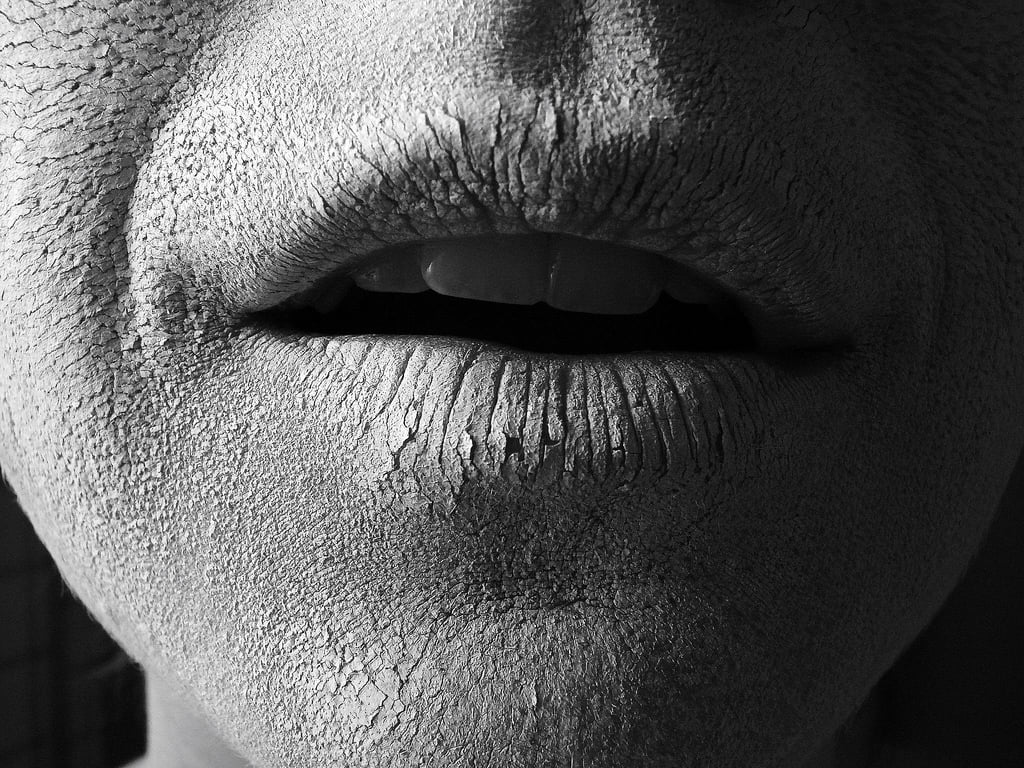 dry mouth