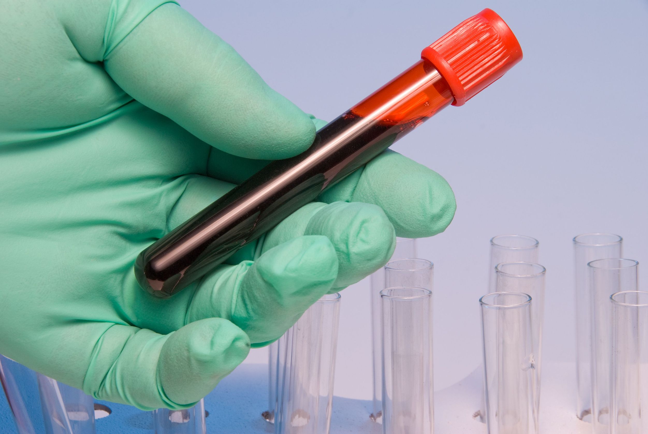 blood sample pathology