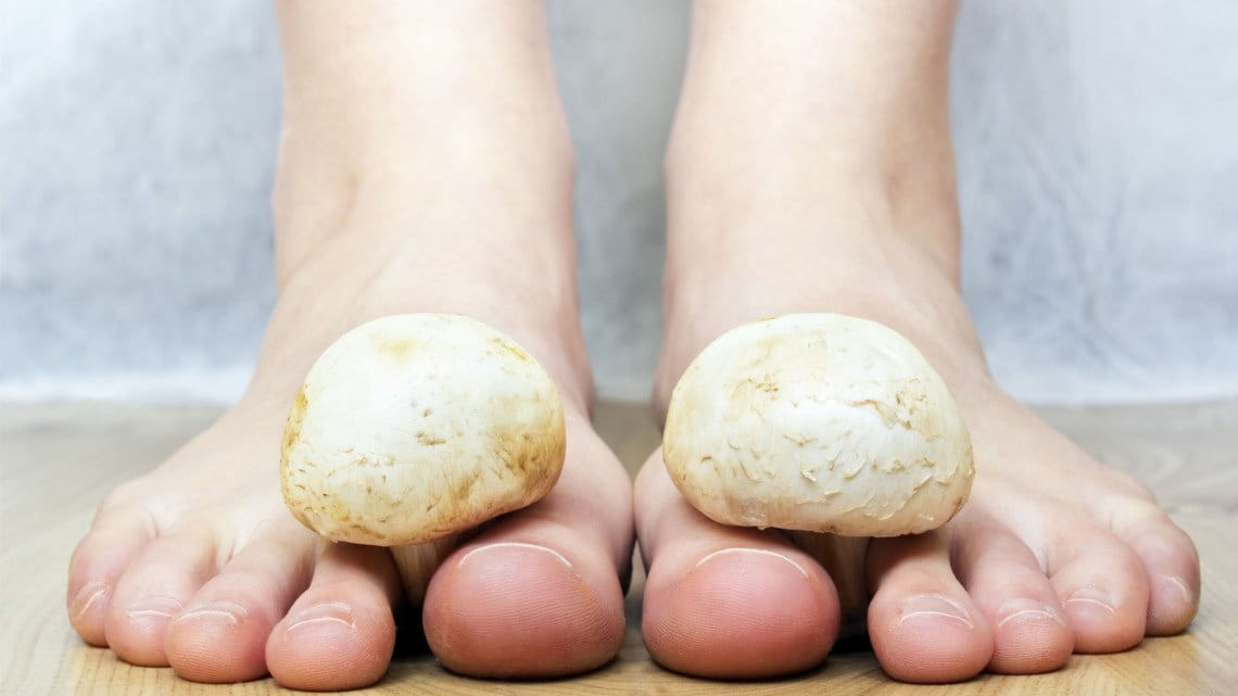 fungal infection feet