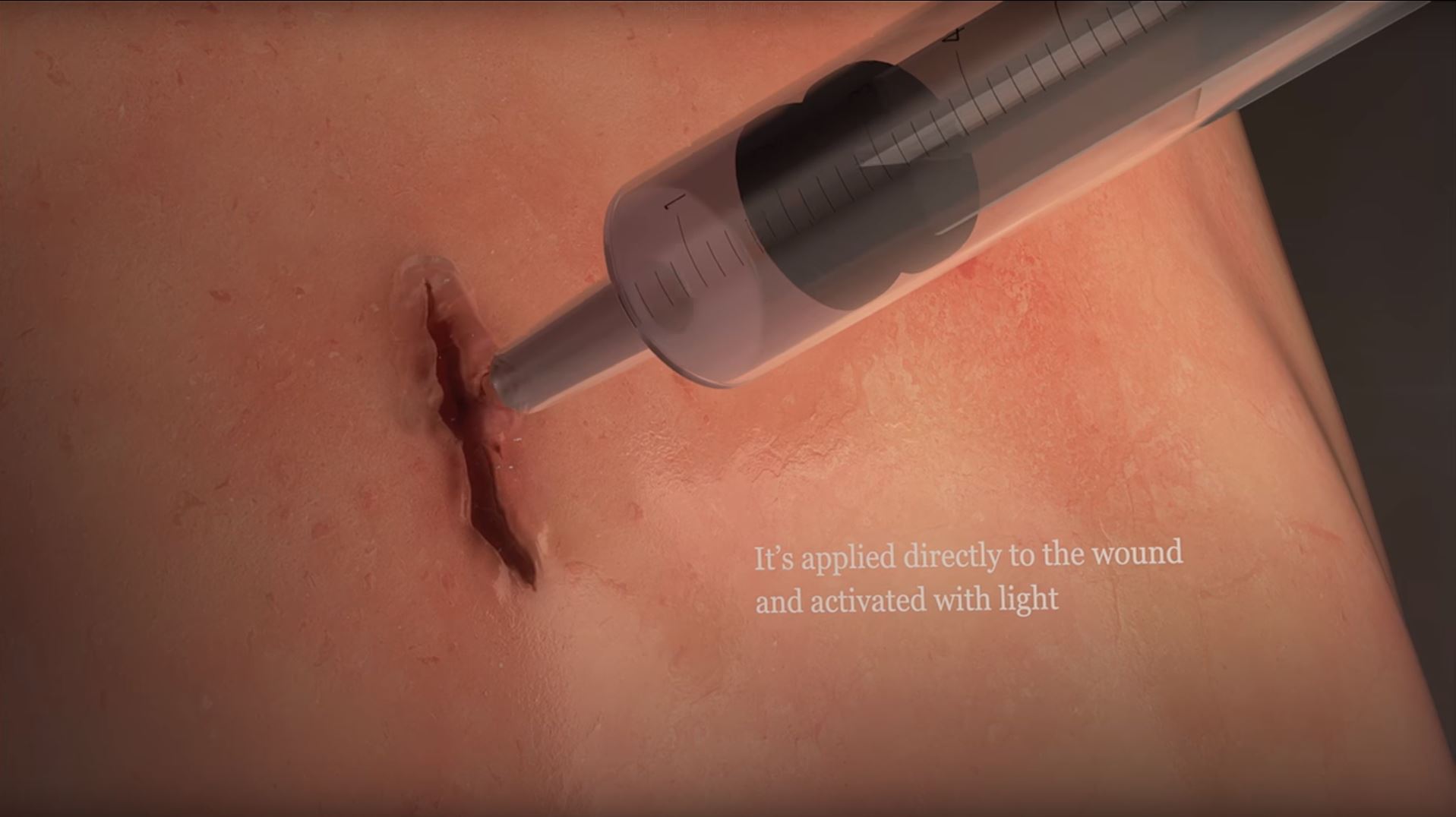 An artist's impression of the glue in action.
